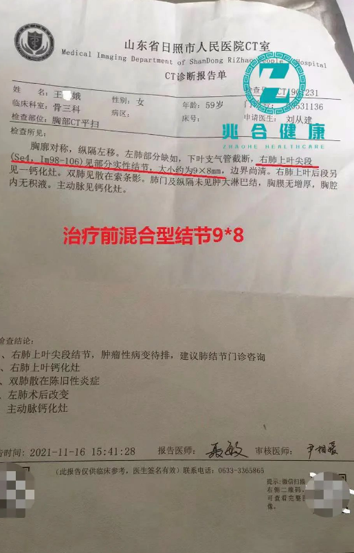 病例追踪：金草消毒颗粒干预2例早期癌前病变“肺结节”均有效！ 最新动态 第4张