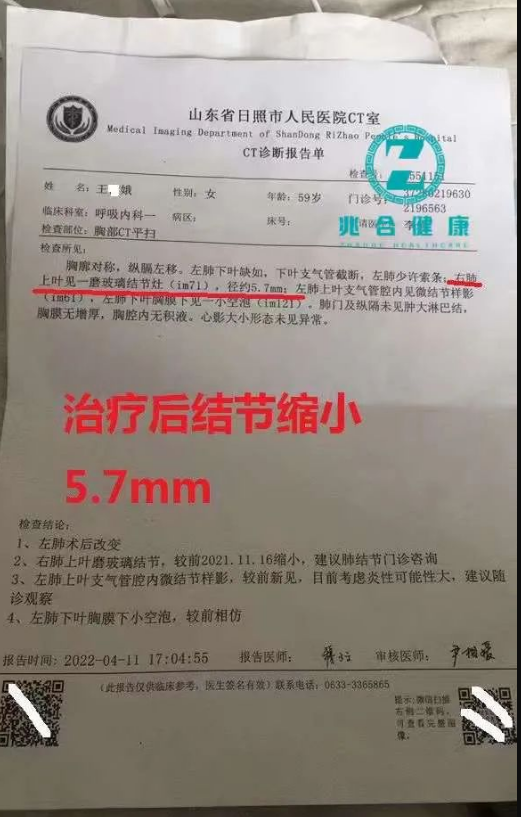 病例追踪：金草消毒颗粒干预2例早期癌前病变“肺结节”均有效！ 最新动态 第5张